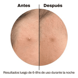 Spot Patches Corazón Celavi