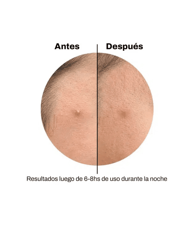 Spot Patches Corazón Celavi