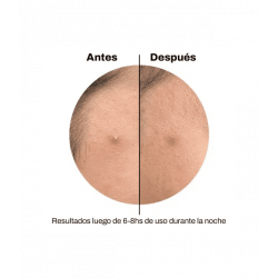 Spot Patches Carita Feliz Celavi