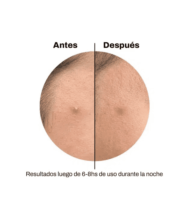 Spot Patches Arcoiris Celavi